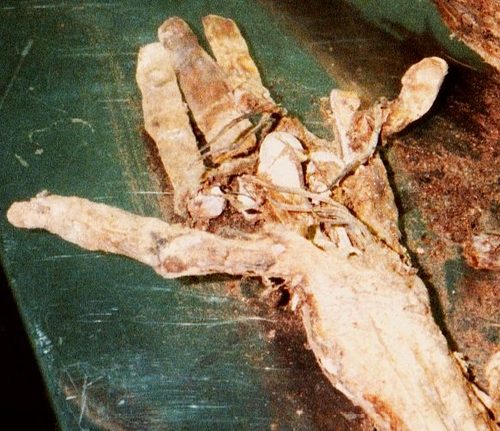 mummified body parts